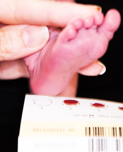 Tamiz Neonatal - CIMA